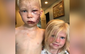 6-year-old boy saves younger sister from charging dog